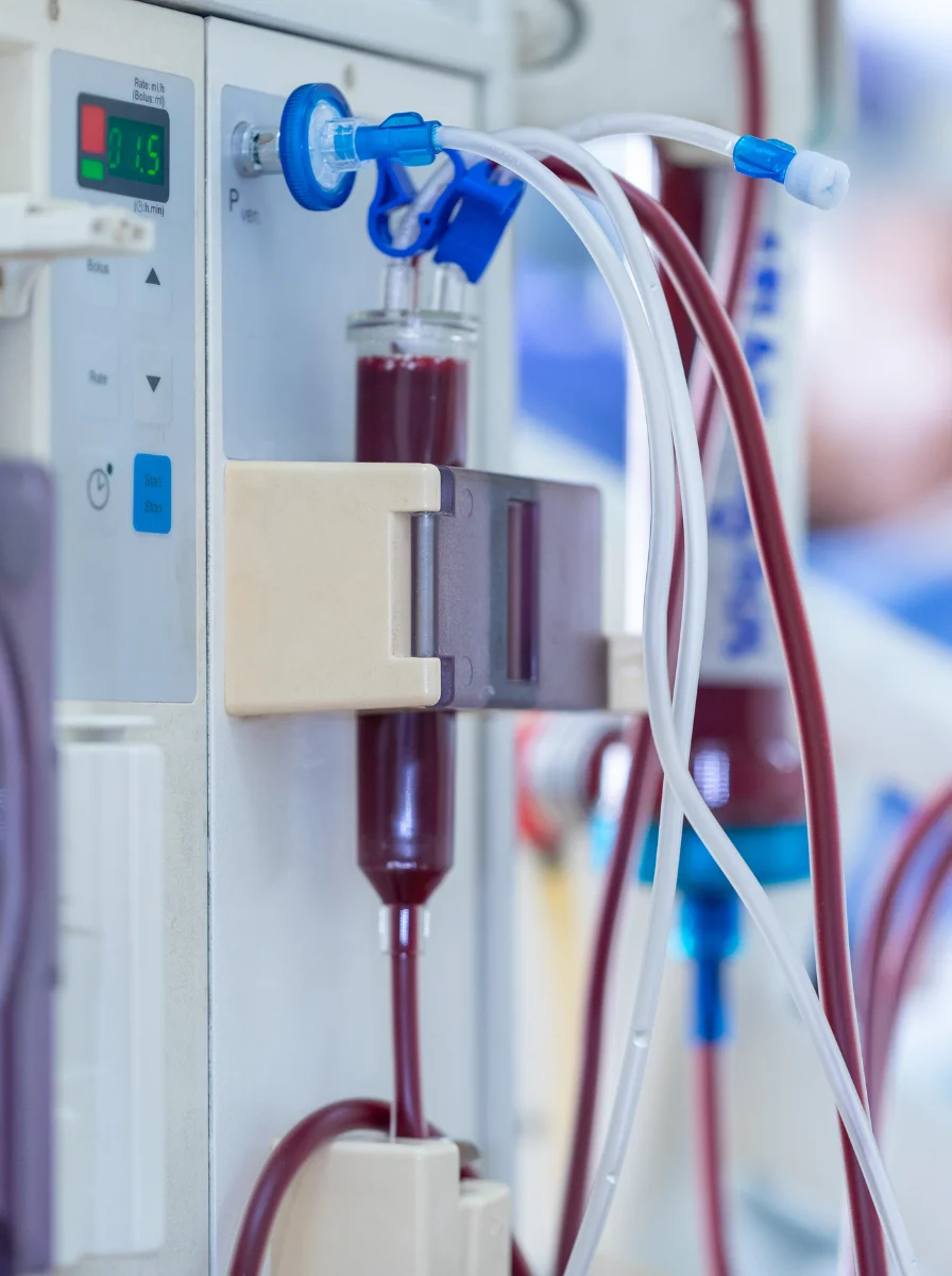 Kidney Failure & Dialysis